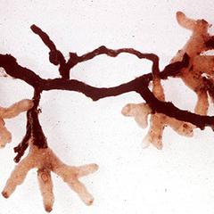 Mycorrhizae of pine