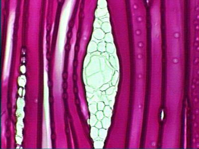Resin duct in a xylem ray in tangential section of pine wood