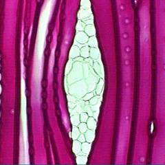Resin duct in a xylem ray in tangential section of pine wood