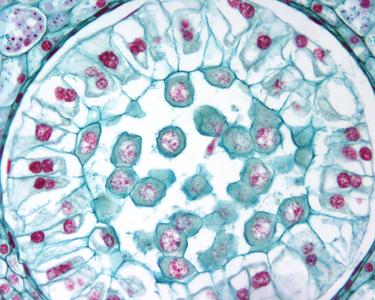 Lilium bud - microspore mother cells in Prophase I