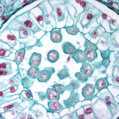 Lilium bud - microspore mother cells in Prophase I