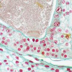 Pine ovule - first cytokinesis of zygote with phragmoplast