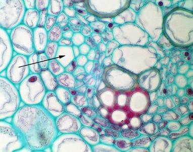 Ranunculus root - protophloem sieve tube element seen in cross section of an immature root