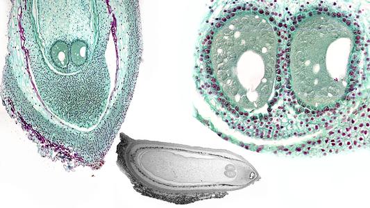Composite of older pine ovule before fertilization