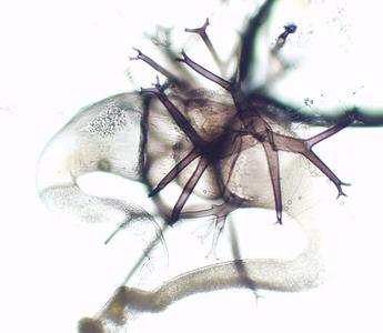 Zygosporangium of Phycomyces