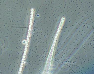 Anabaena filaments with bacilli shaped heterotrophic bacteria - 100x objective, dark field illumination