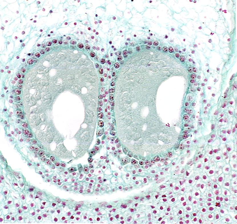 Pine pollen - 40x objective - UWDC - UW-Madison Libraries