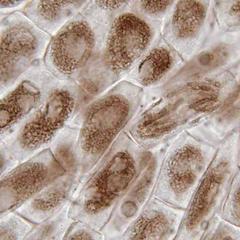 Prophase and anaphase from a Narcissus root squash