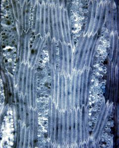 Detail of vascular cambium seen in tangential section of black locust