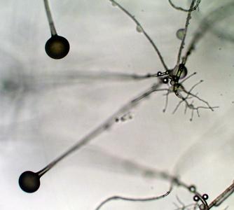 Rhizopus - four different types of hyphae