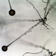Rhizopus - four different types of hyphae