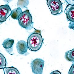 Early prophase I - Lilium microsporogenesis