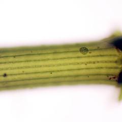 Chara - corticating cells with attached Coleochaete