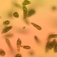 Euglena movie of swimming cells - 40x DIC objective