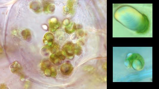 Stages showing amyloplasts in potato transforming into chloroplasts