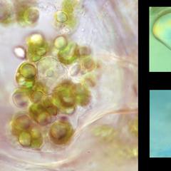 Stages showing amyloplasts in potato transforming into chloroplasts