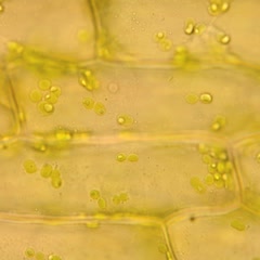Views of Elodea tissue with DIC illumination using a 100x objective showing mitochondria, chloroplasts, and nuclei with visible nucleoli
