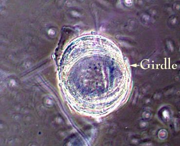 Diatomaceous earth with DIC illumination - oblique view of a centric diatom