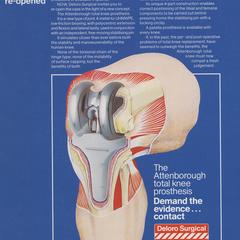 Deloro Surgical advertisement